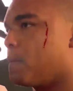 Heavyweight boxer left bleeding after brawl at Press Conference