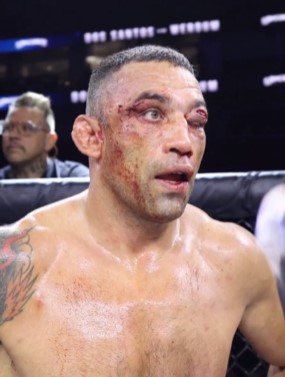 Former UFC Heavyweight Champion left with a brutal eye injury and covered in blood after a bare-knuckle battle