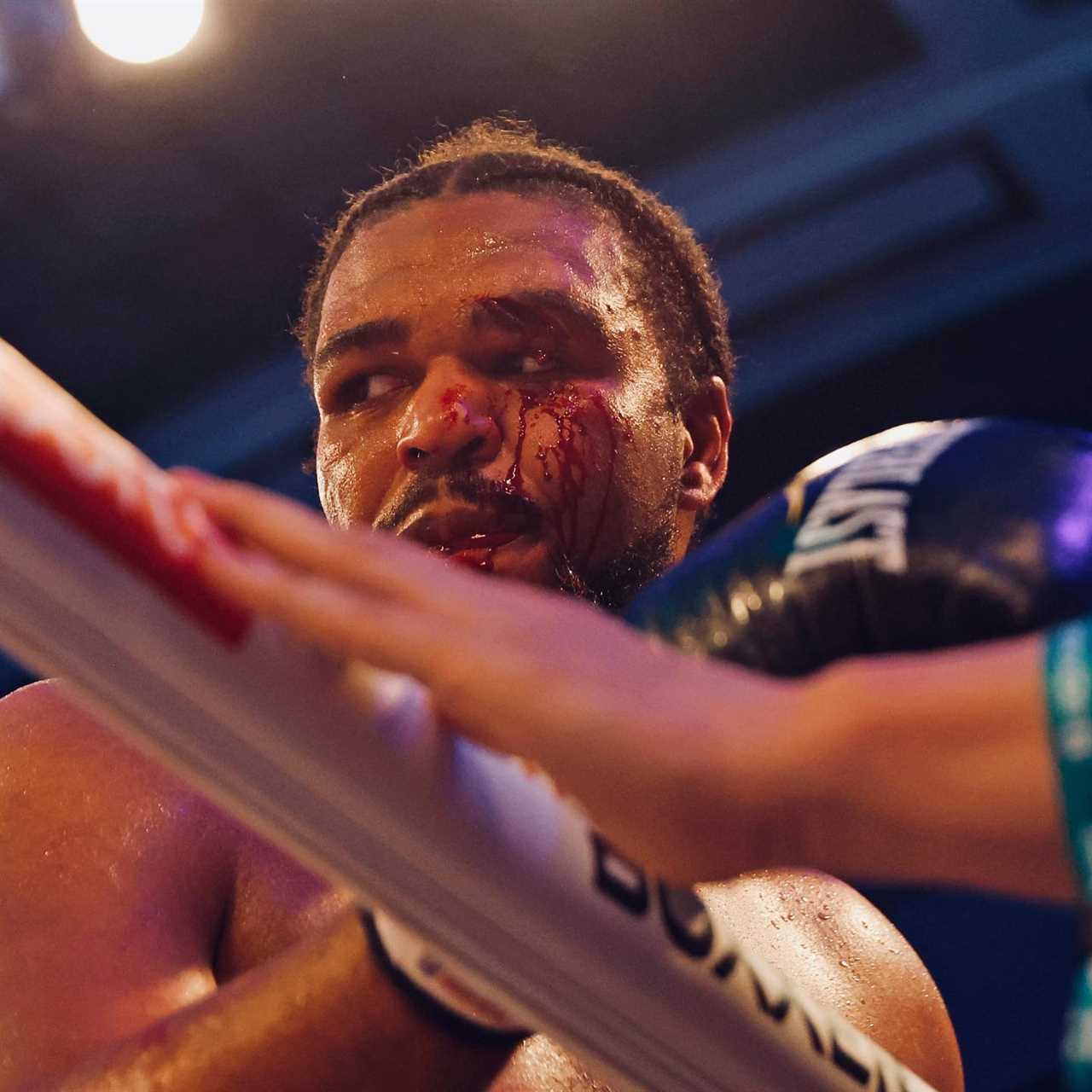 Igor Macedo, TKV's shock loss to Igor Macedo, suffers a horrific eye injury
