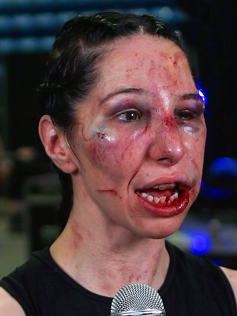 British Bare-Knuckle Fighter Unrecognisable after Brutal Fight