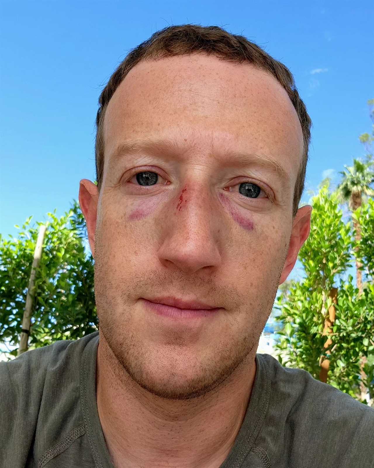 Mark Zuckerberg reveals his black eyes in advance of a possible fight with Elon Musk