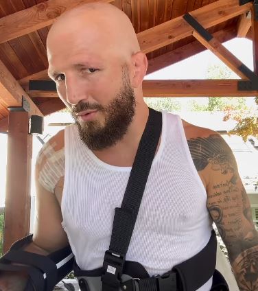 Former UFC champ TJ Dillashaw shocks fans with new bald look