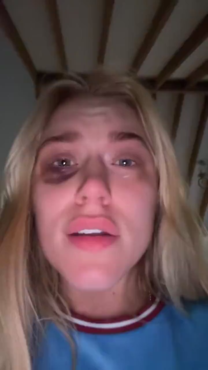 OnlyFans boxer shows off massive black eye as Elle Brooke, a tearful Elle Brooke, says that Man City is 'finished' following Arsenal's loss.