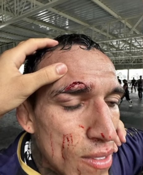 Charles Oliveira forced out of Makhachev Rematch due to horrific cut
