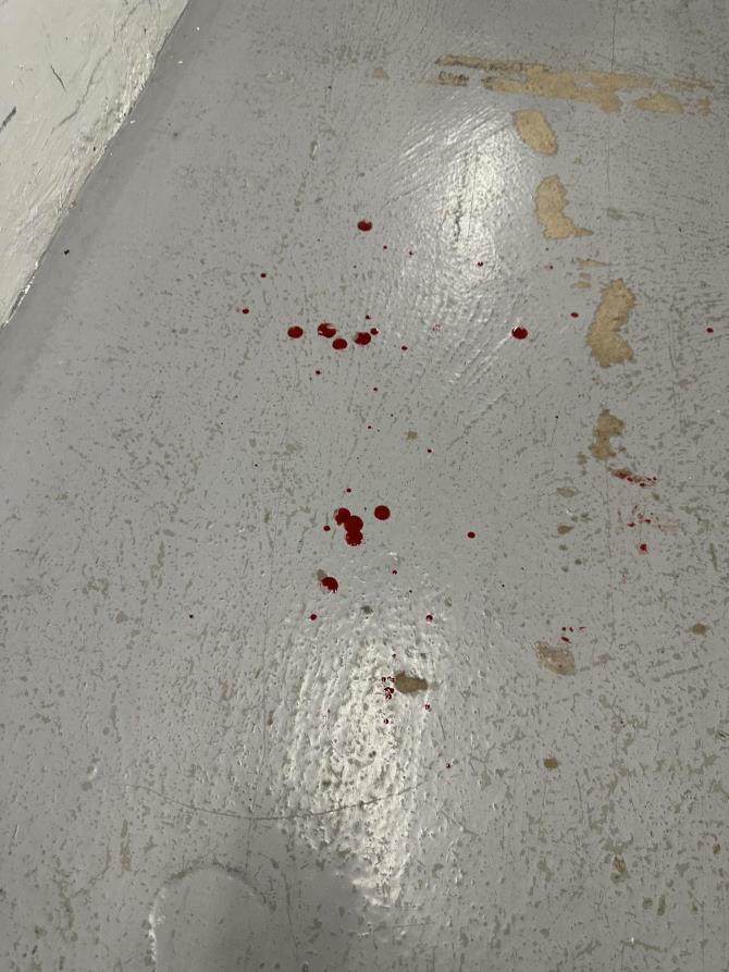 Logan Paul shows swollen cheek after Dillon Danis's chaotic pre-fight assault