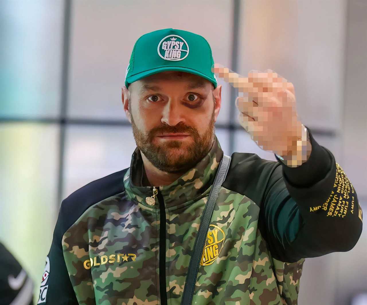 Fury flips the bird as he returns to the UK with an injured eye after his fight with Ngannou