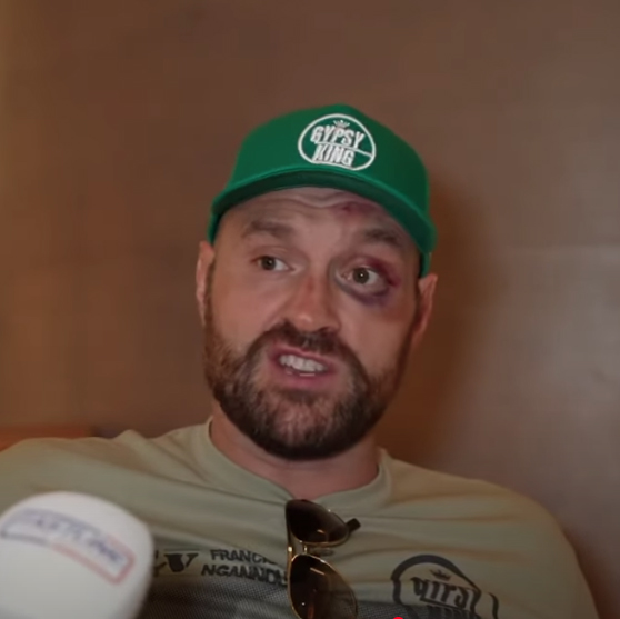 Tyson Fury faces Oleksandr Usyk in December despite his battered face after Francis Ngannou fight