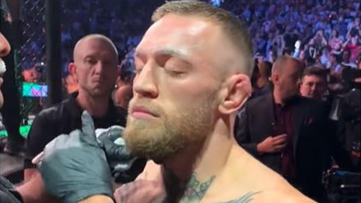 UFC Stars' Secret Weapon: Why They Use Vaseline on Their Faces