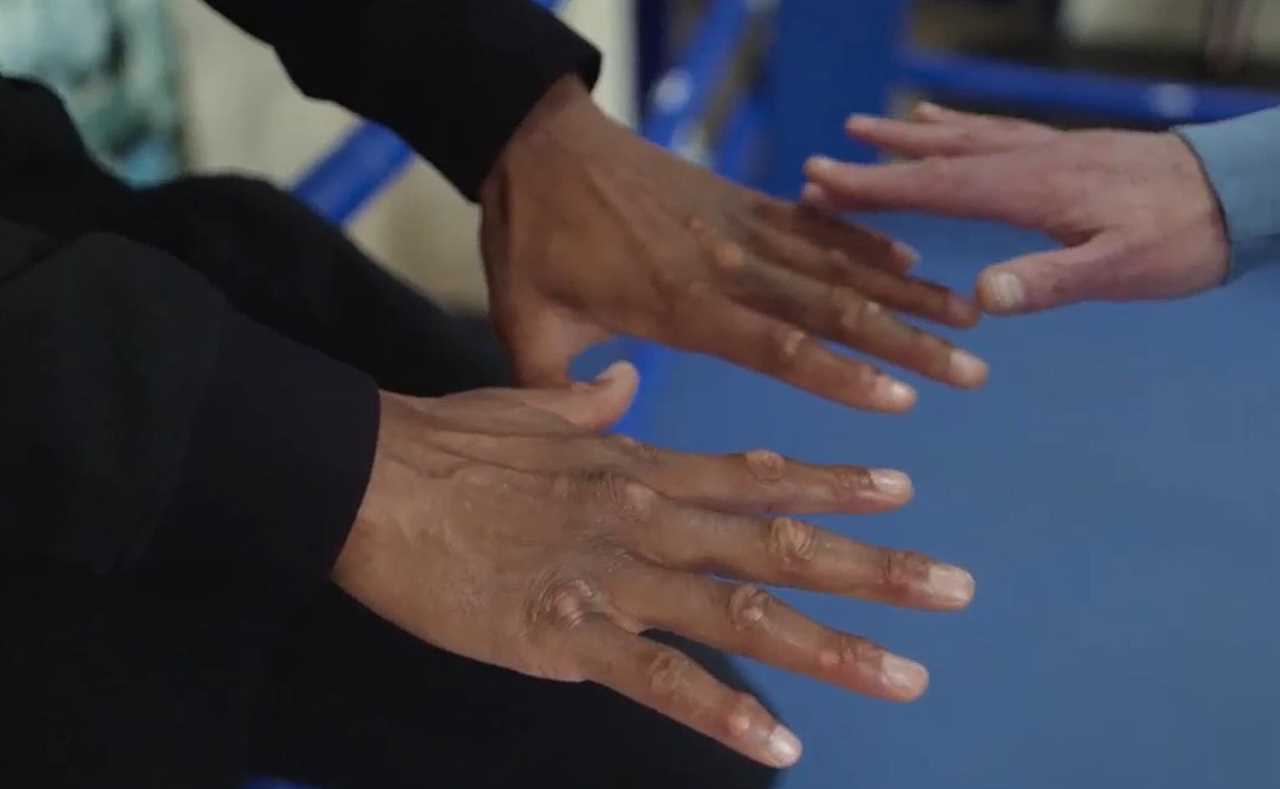 Anthony Joshua reveals gruesome scars from street fight on his way to get chicken