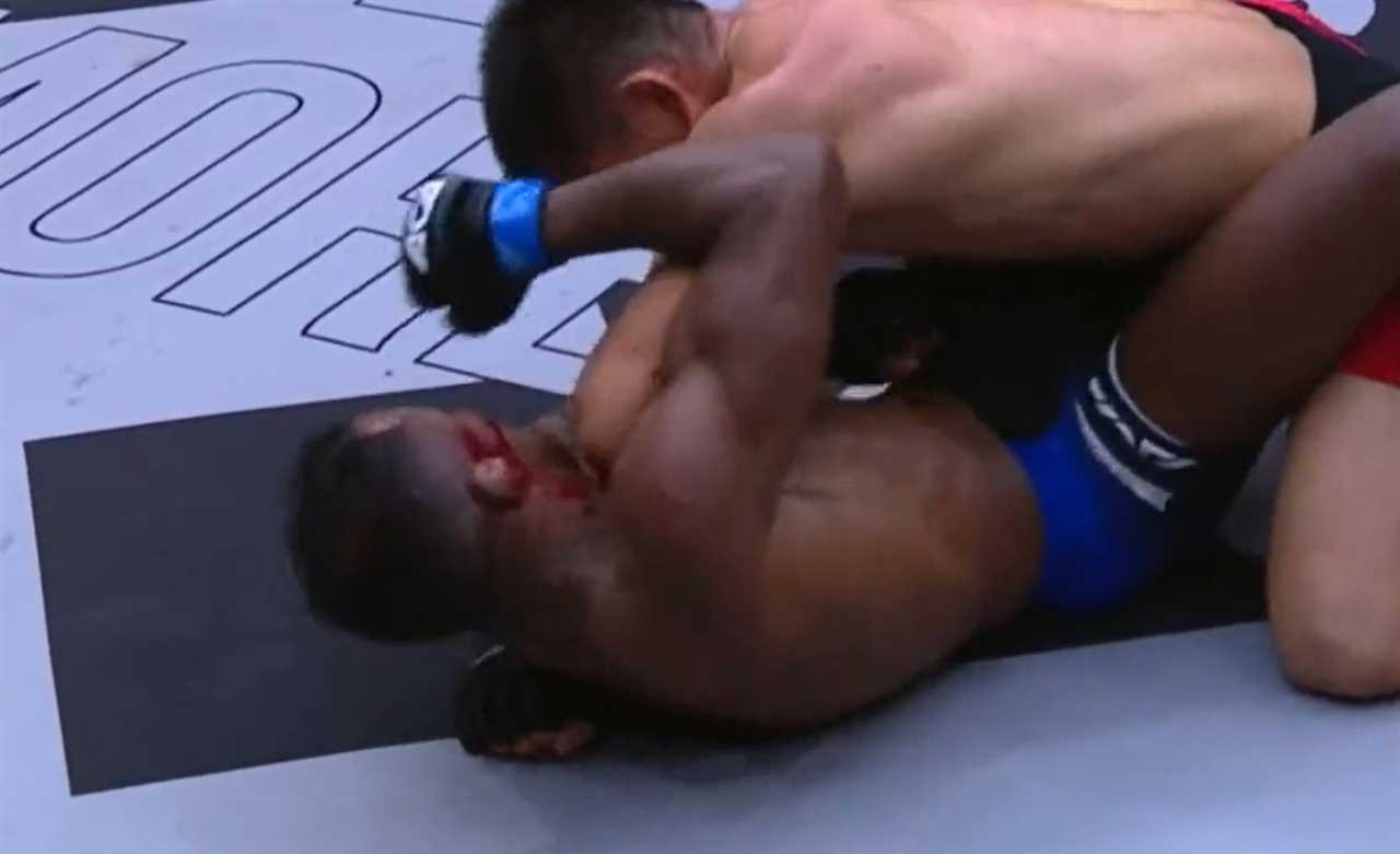 Shocking Moment MMA Fighter's Ear Explodes and Hangs Off His Face in Bloody Fight as Doctor Stops Bout