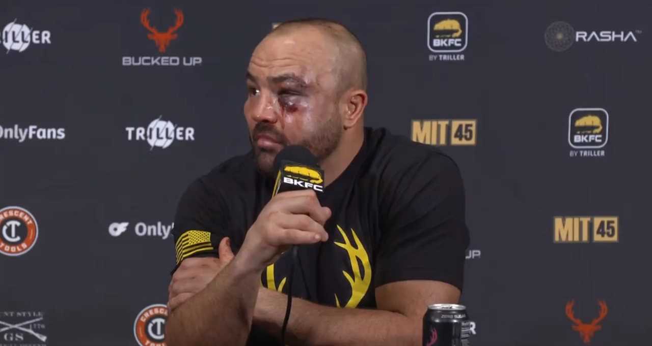 Former UFC Champion Eddie Alvarez Suffers Horrific Facial Injuries in Bare-Knuckle Boxing Defeat