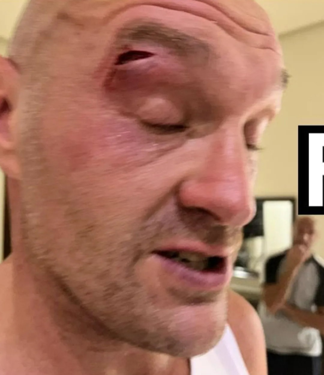 Oleksandr Usyk is praised for his reaction to Tyson Fury’s fight postponement