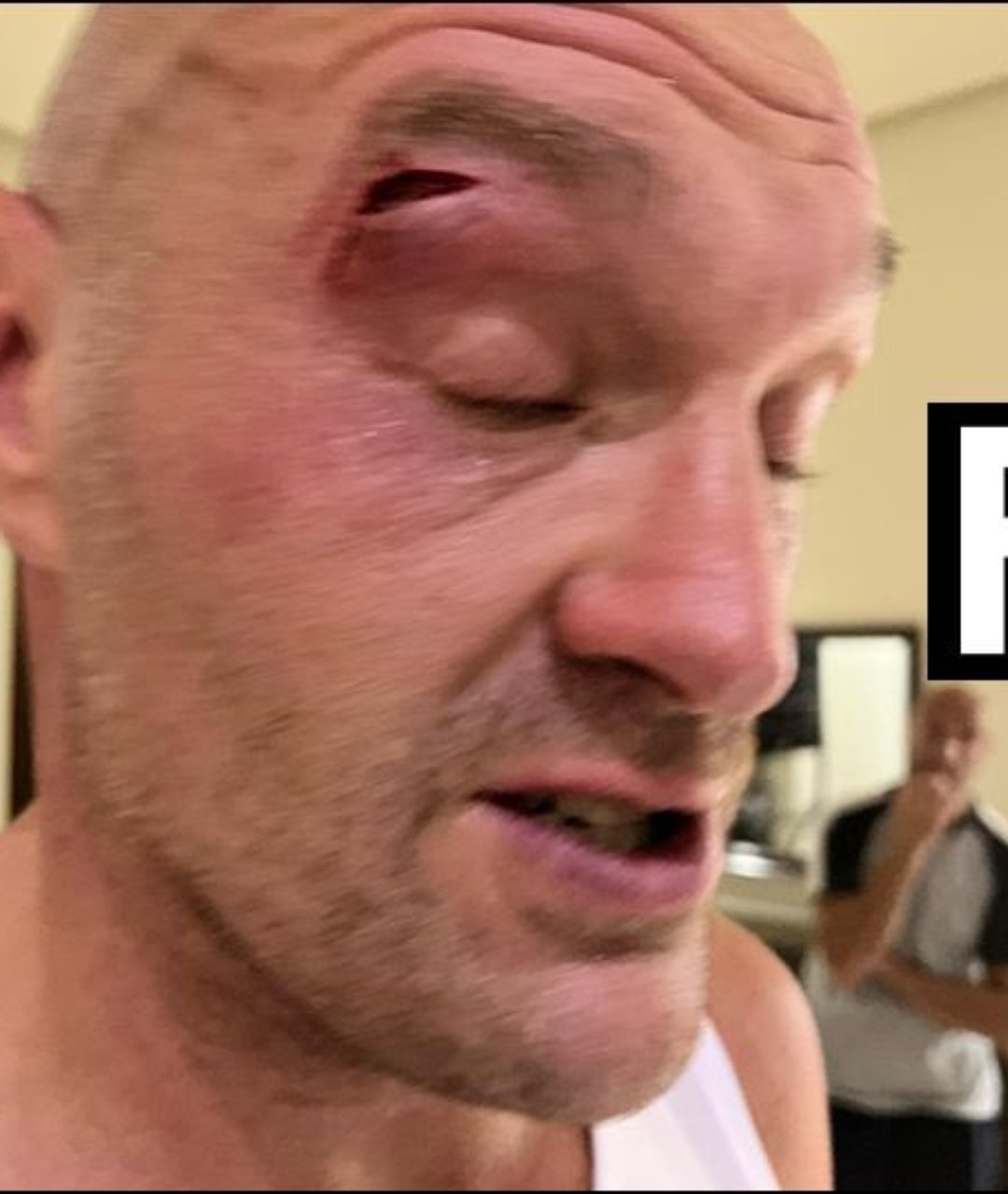 Tyson Fury’s Fiery Twitter Haunts him After Usyk Fight Rescheduled