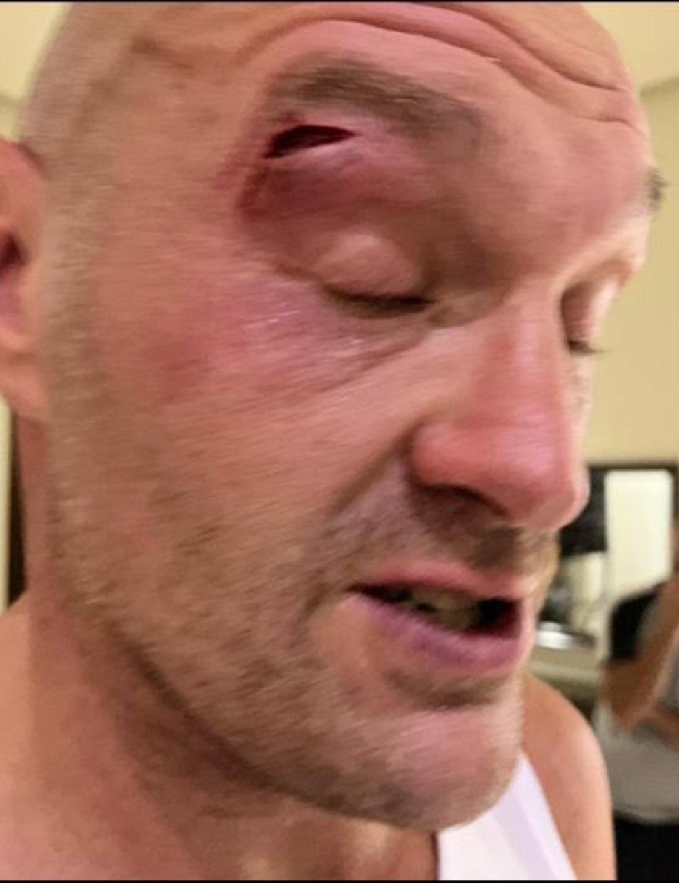 Anthony Joshua's former sparring partner breaks silence on cutting Tyson Fury