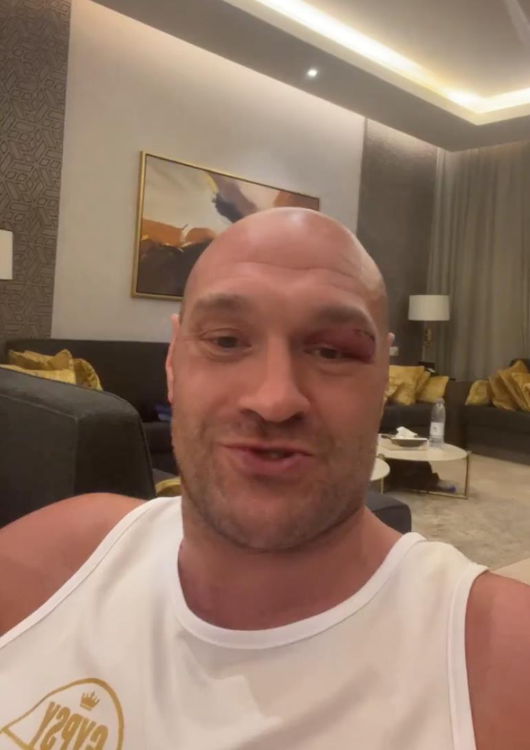 Tyson Fury Responds to Oleksandr Usyk’s Retirement Claims, and Issues a Warning Ahead of the May 18 Showdown