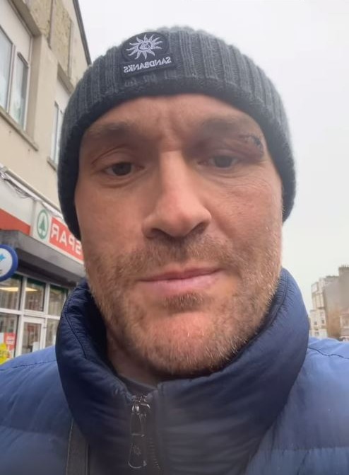 Tyson Fury returns home with a horror eye cut after delaying fight