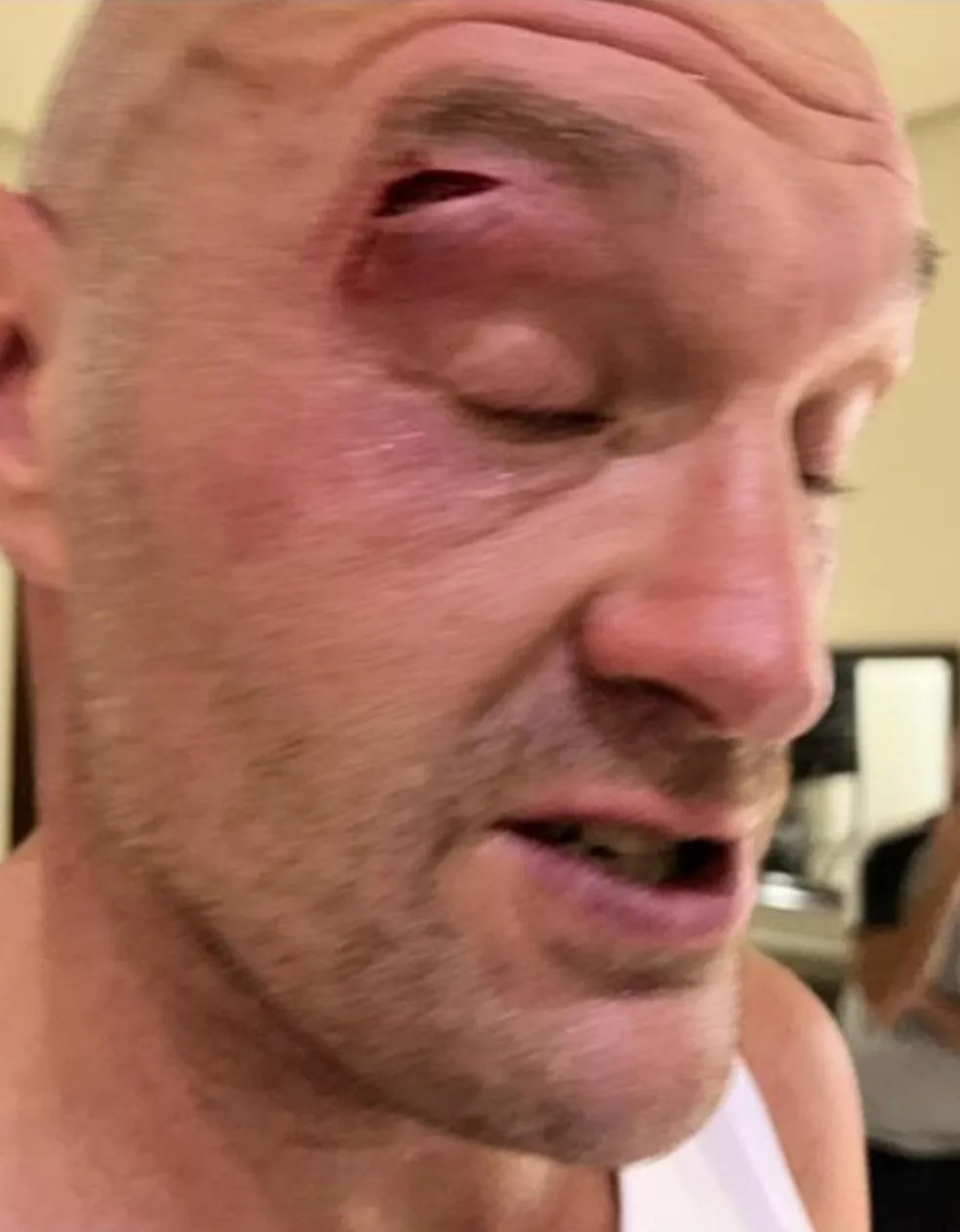 Oleksandr Usky Hits Tyson Fury with PS10 Million Refusal Clause After Rescheduled Fight
