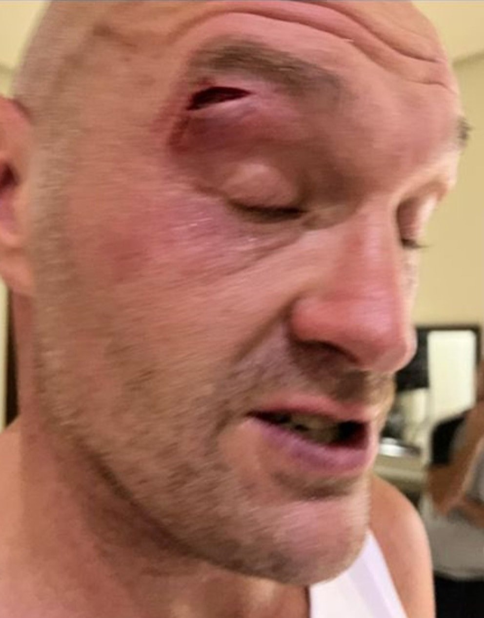 Boxing legend Cutman joins Tyson Fury’s camp for Usyk Fight