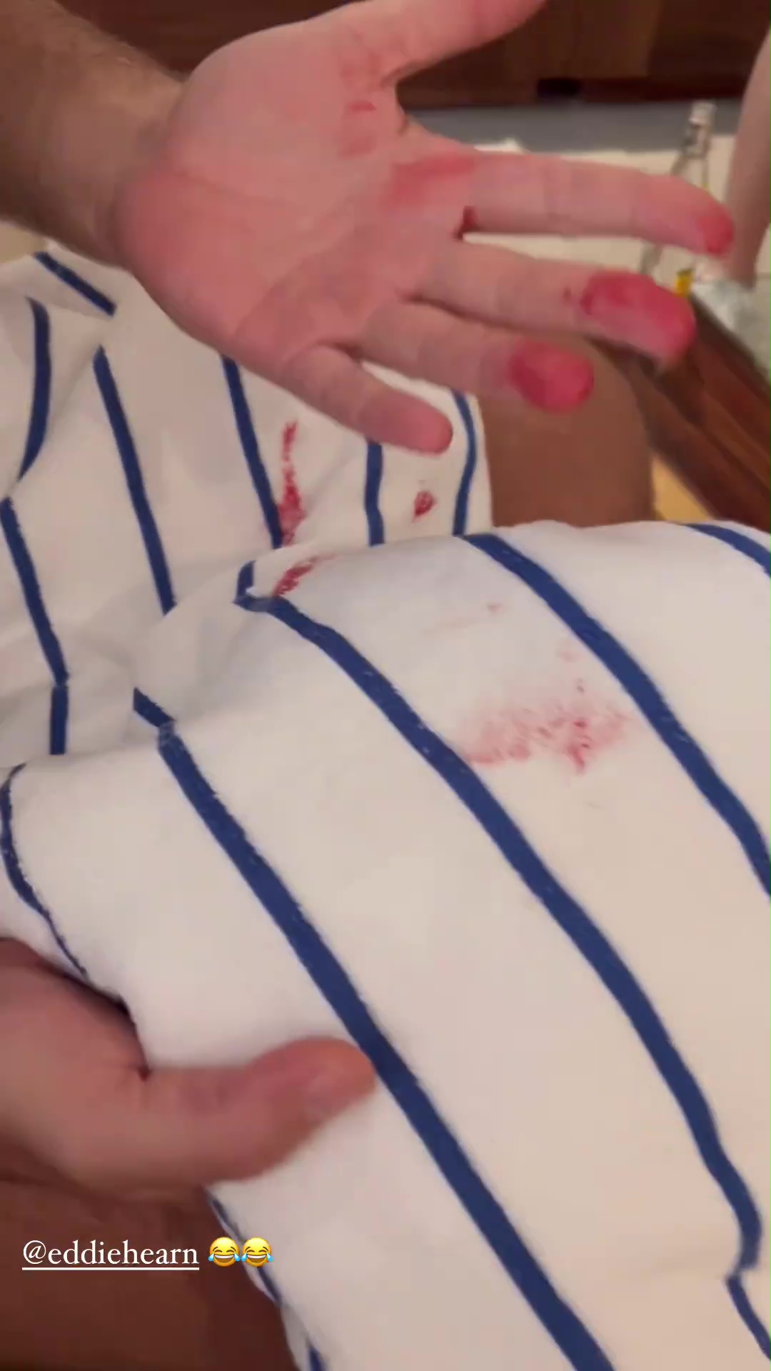 Eddie Hearn Left Bleeding After Celebrating Boxer's Win