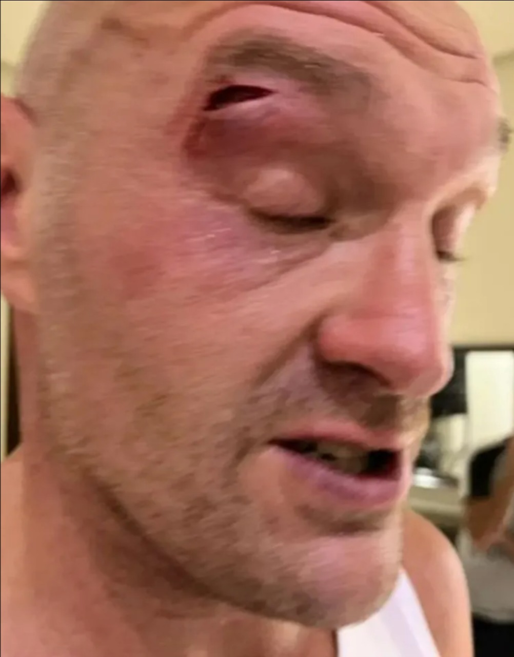 Tyson Fury shares a reminder of his incredible body transformation ahead of the Axed showdown with Usyk