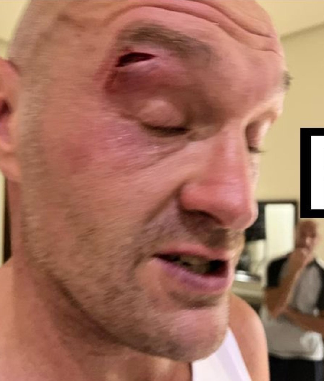 Joseph Parker responds to Tyson Fury's conspiracy theories about a 'fake-cut' that delayed the fight with Usyk