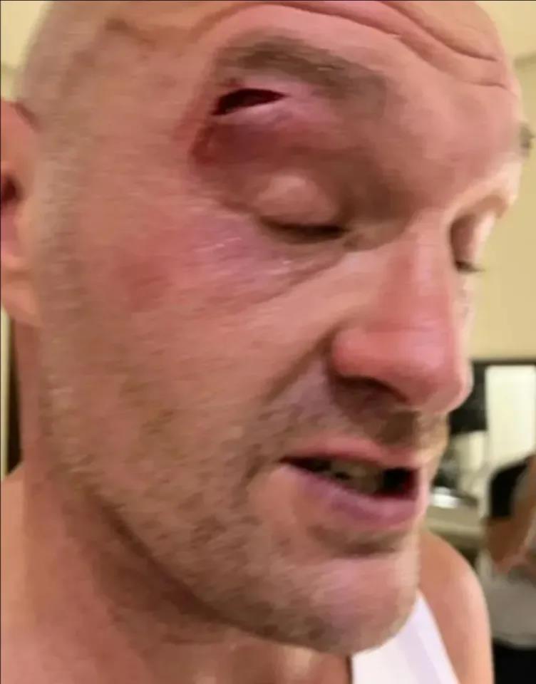 Tyson Fury's Diet Revealed Ahead of Oleksandr Usyk Fight