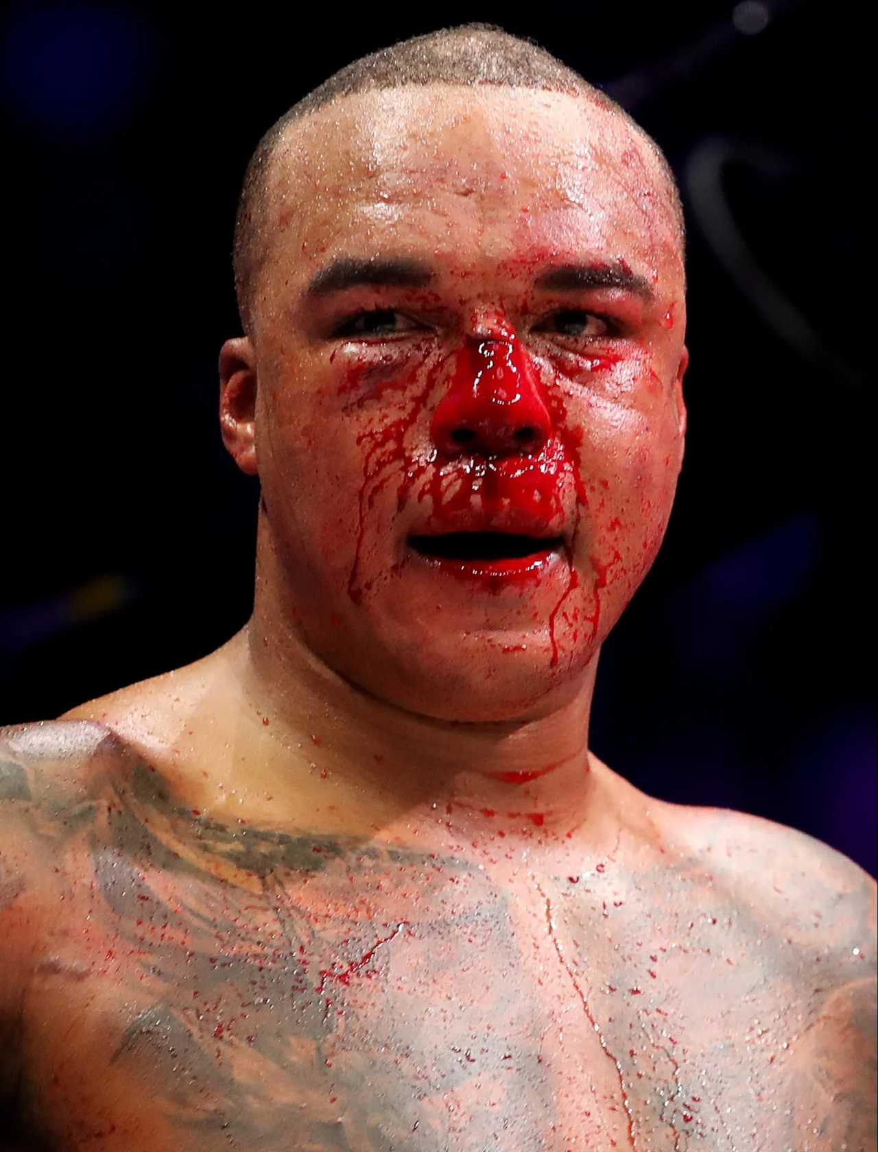 Fabio Wardley’s Bloody Nose Described As 'Horror Show in Brutal Drawing with Frazer Clarke