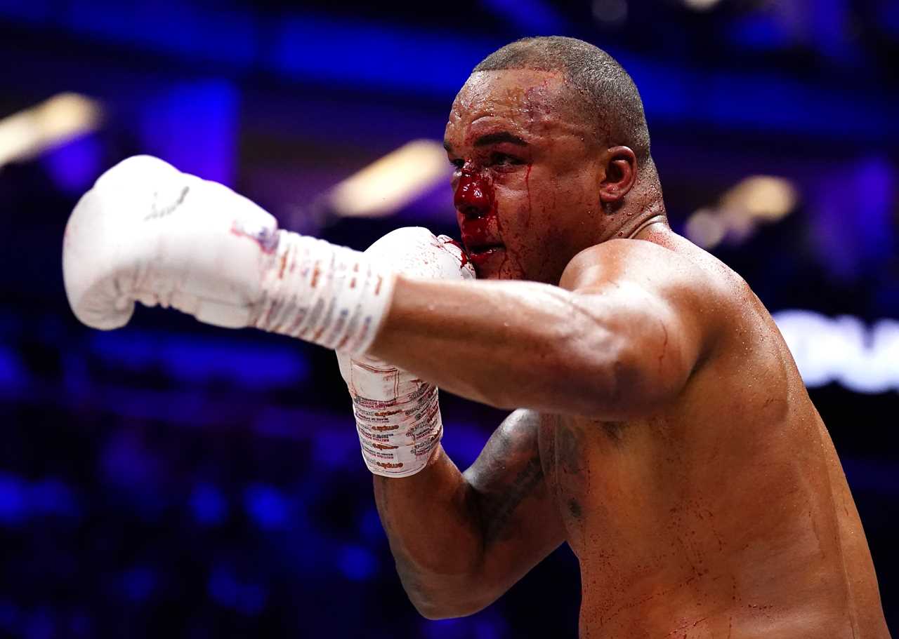 Fabio Wardley admits thrilling bloodbath bout took years off his life