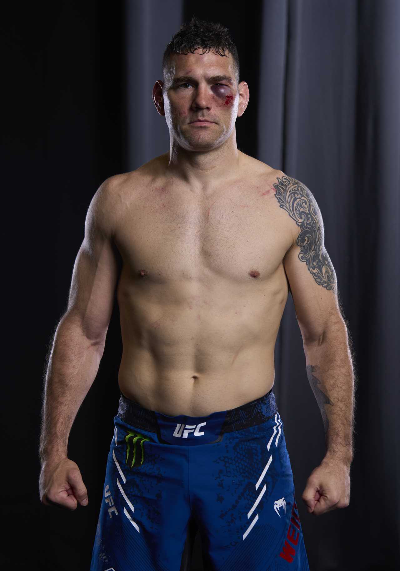 UFC star looks like Terminator after controversial fight