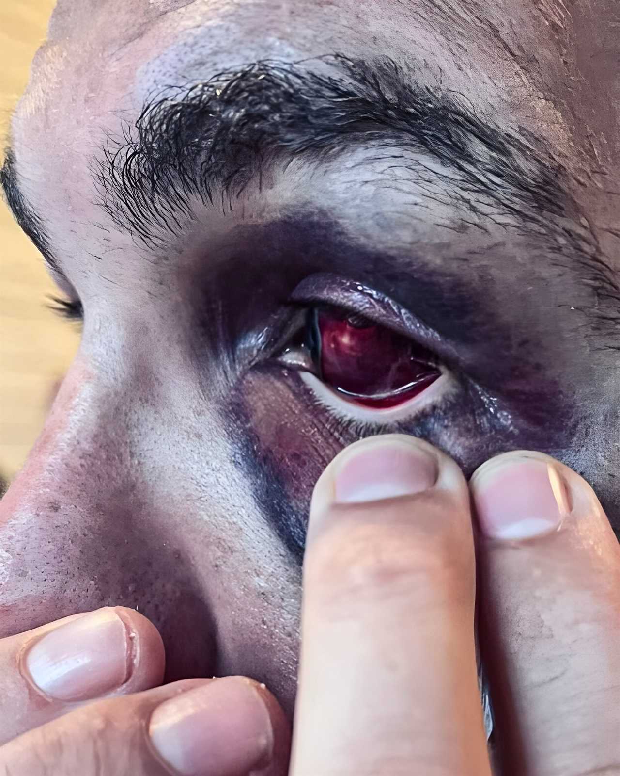 UFC star looks like Terminator after controversial fight