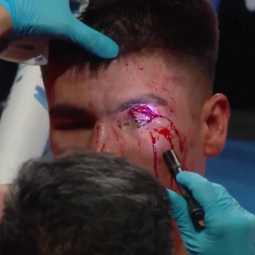 Boxers' bout halted due to gruesome cuts