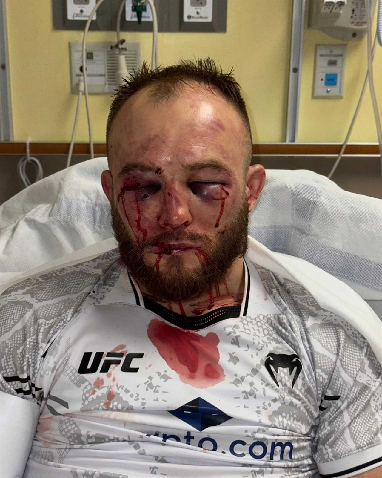 UFC Star Mateusz Rebecki Shares Gruesome Photo After Loss