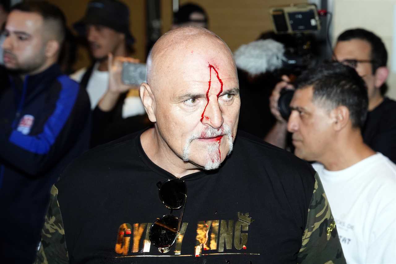 Tyson Fury Spotted Leaving Media Day on Crutches Ahead of Usyk Fight