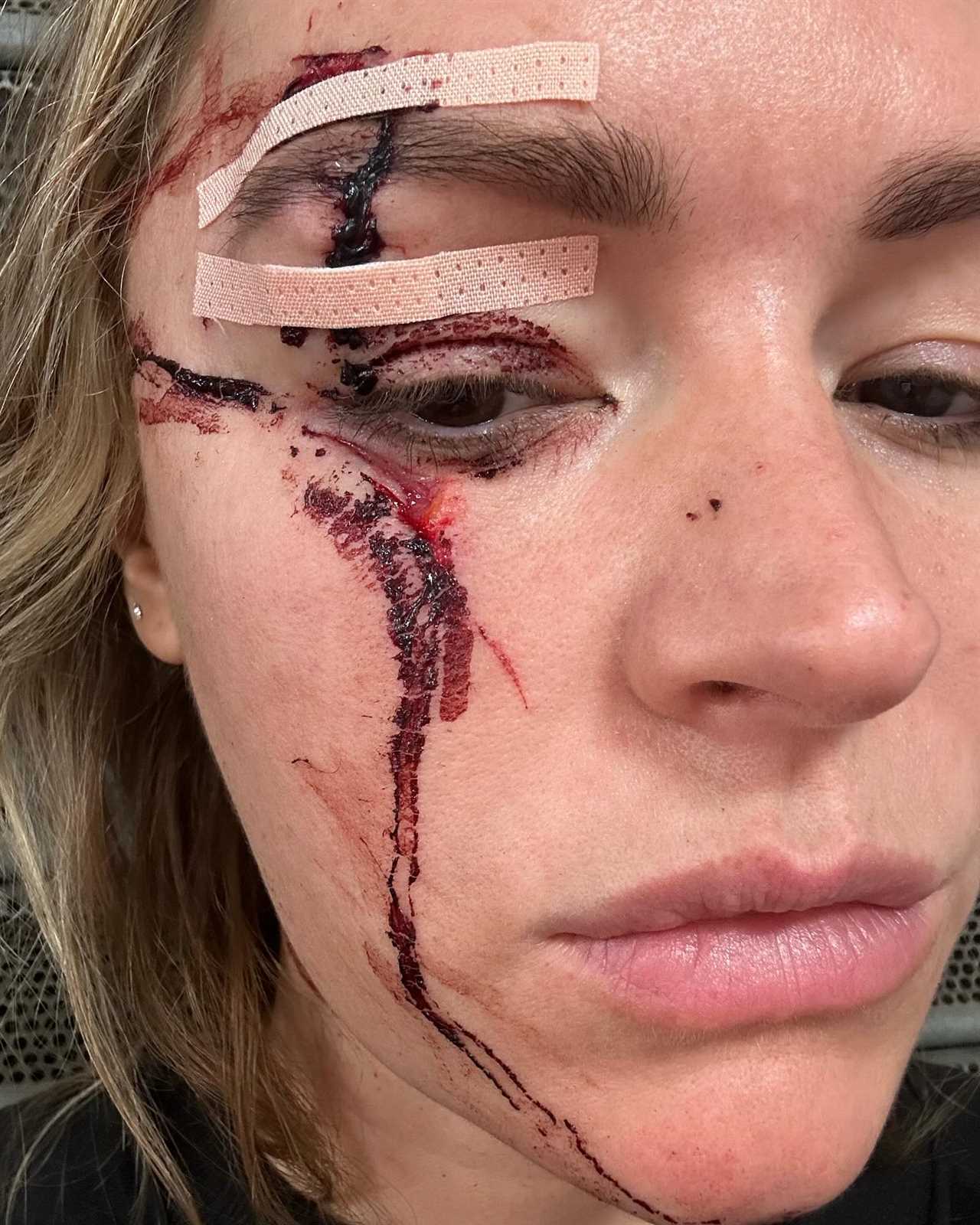 Laura Woods Pulls Out of Hosting Tyson Fury vs Oleksandr Usyk Due to Horror Injury