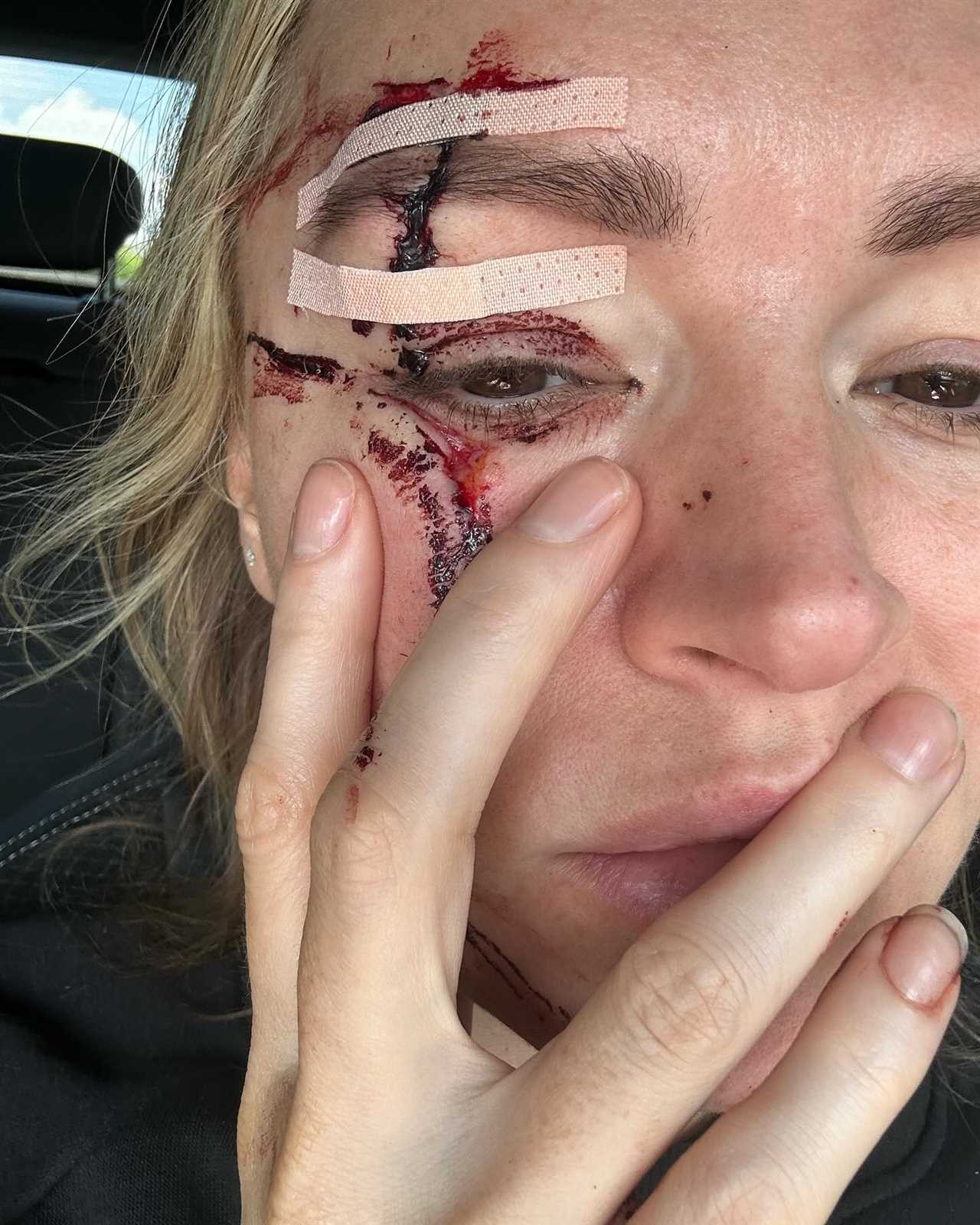 Laura Woods Pulls Out of Hosting Tyson Fury vs Oleksandr Usyk Due to Horror Injury