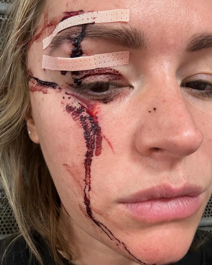 Laura Woods Pulls Out of Presenting Tyson Fury vs Oleksandr Usyk Due to Freak Accident