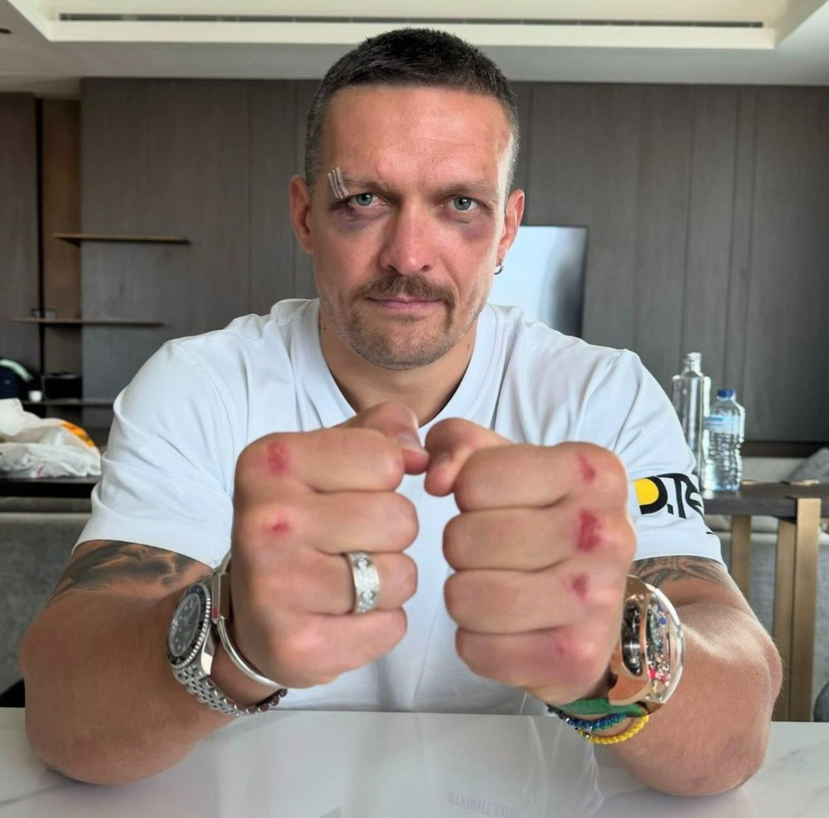 Oleksandr Usyk reveals battle scars after victory over Tyson Fury