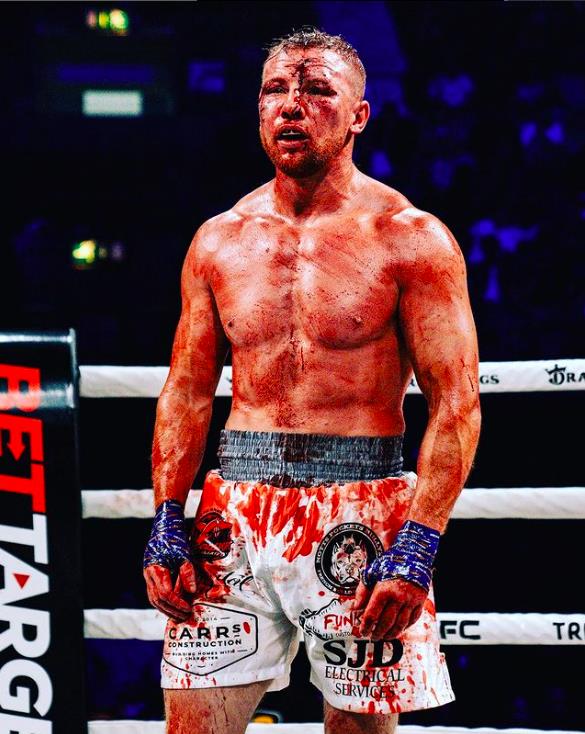 Former Street Fighter, The B****d, Aims for Bare-Knuckle Boxing Stardom After Surviving Tragic Past
