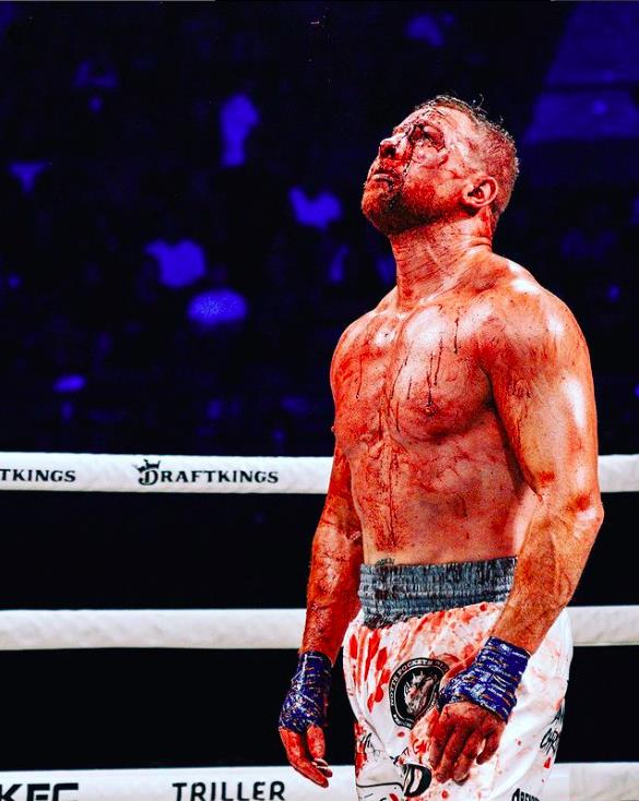 Former Street Fighter, The B****d, Aims for Bare-Knuckle Boxing Stardom After Surviving Tragic Past