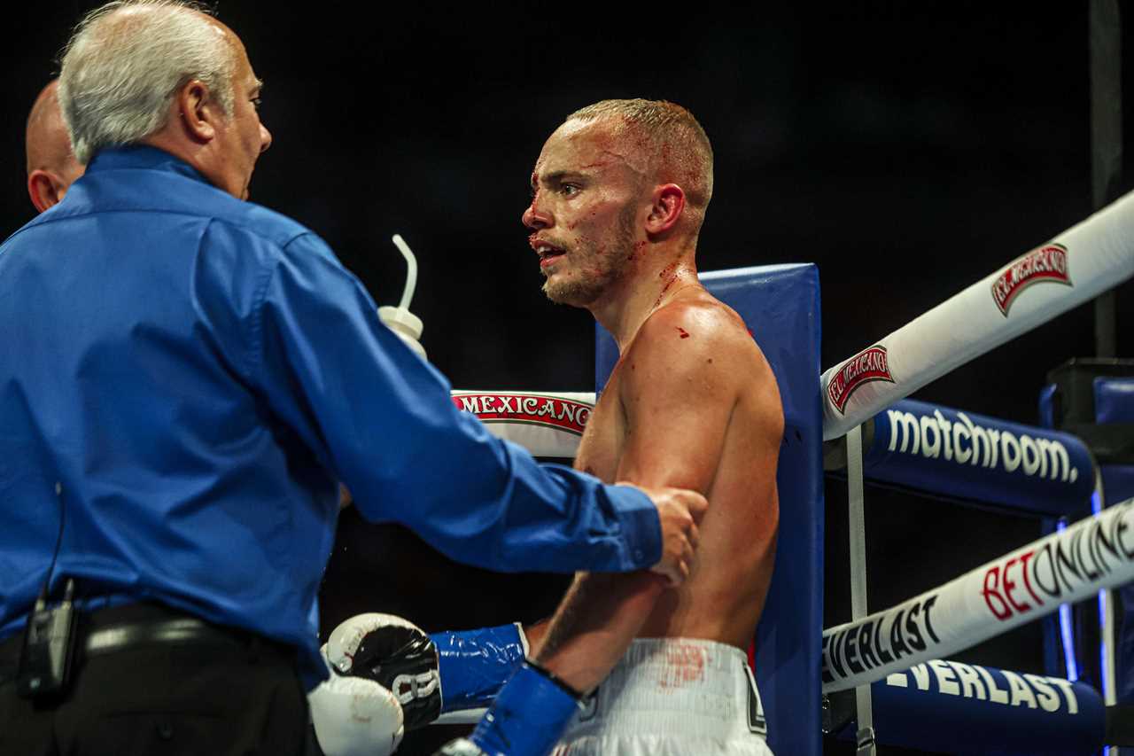 British Boxer Sunny Edwards Suffers Gruesome Cut in Victory