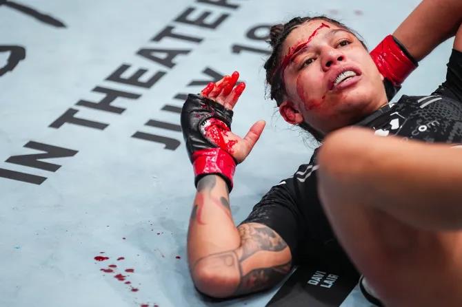 Mayra Bueno Silva reveals gruesome head injury after UFC 303 fight
