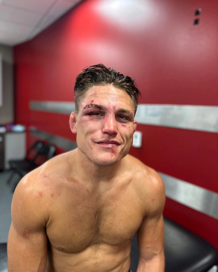 UFC Star Drew Dober Continues Fighting Despite Gruesome Eye Cut