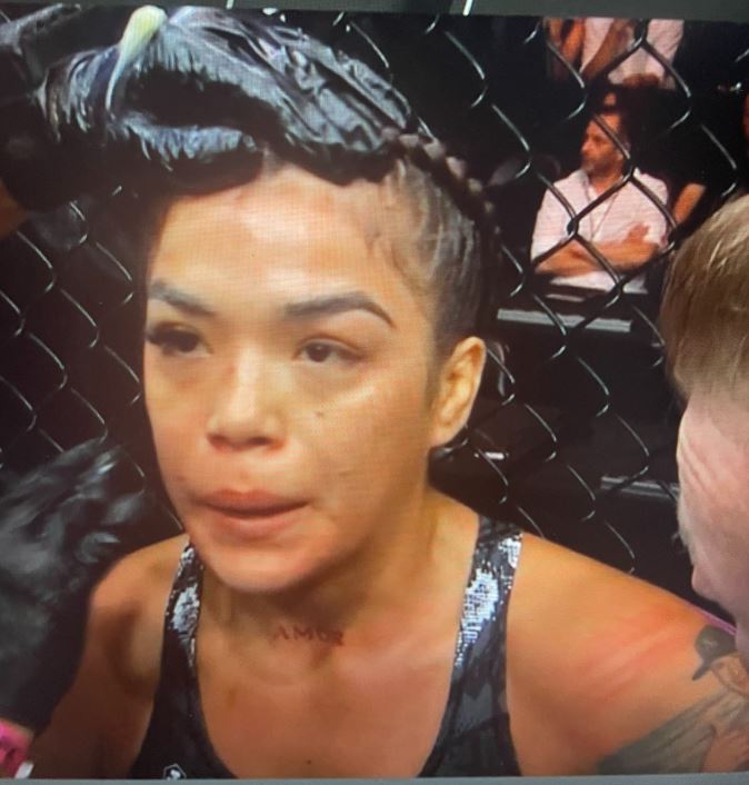 UFC Fight Night Drama: Rose Namajunas Sends Opponent's Eyelash Flying Across Octagon