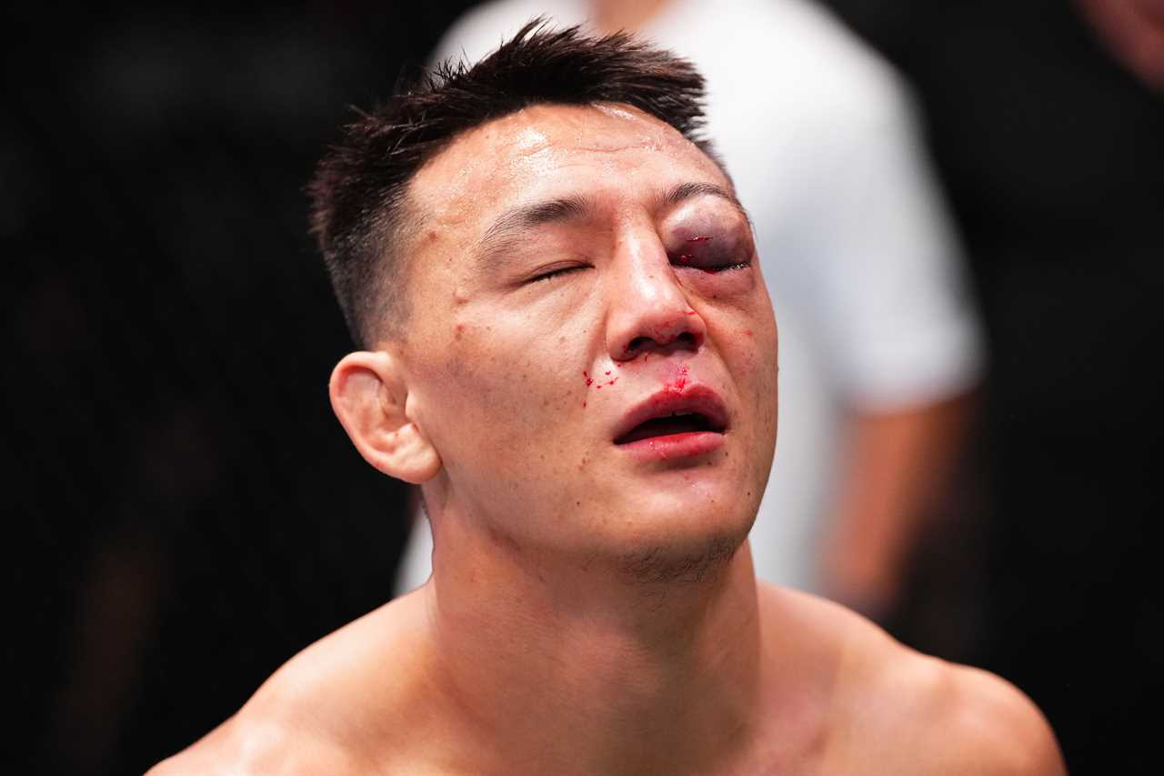 UFC Star Rushed to Hospital with Horror Injury After Brutal Defeat