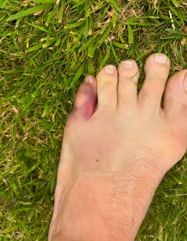 Conor McGregor Goes Up a Shoe Size After Toe Injury, but Confident for December UFC Return