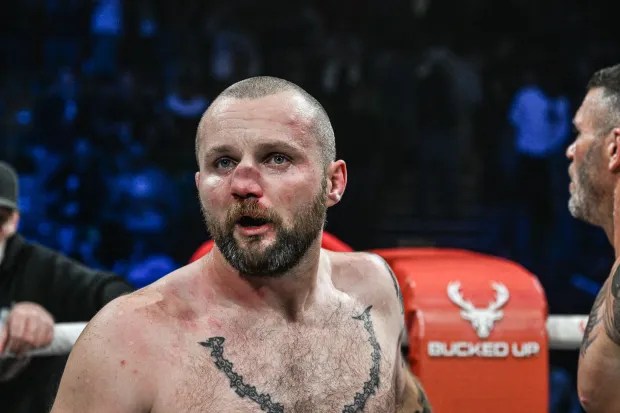 UK Boxer Chris Camozzi Breaks Opponent's Nose in Brutal Bare-Knuckle Fight