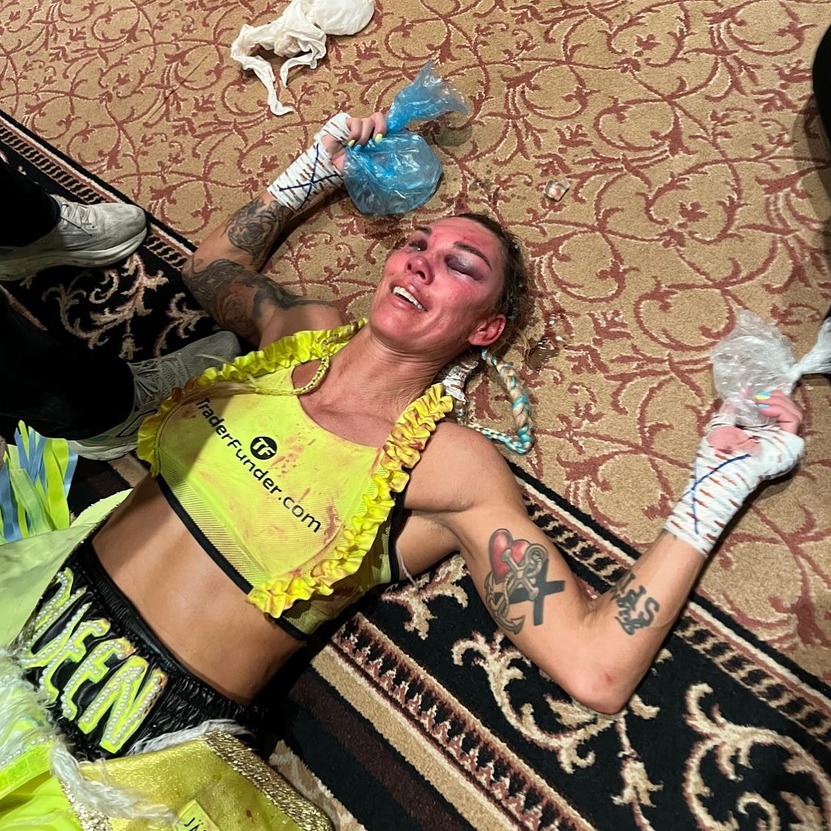Boxer Mikaela Lauren Left Unrecognisable After Horrific Beating by World Champion