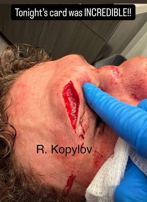 UFC Star Roman Kopylov Suffers Gruesome Cut in Fight Night Clash