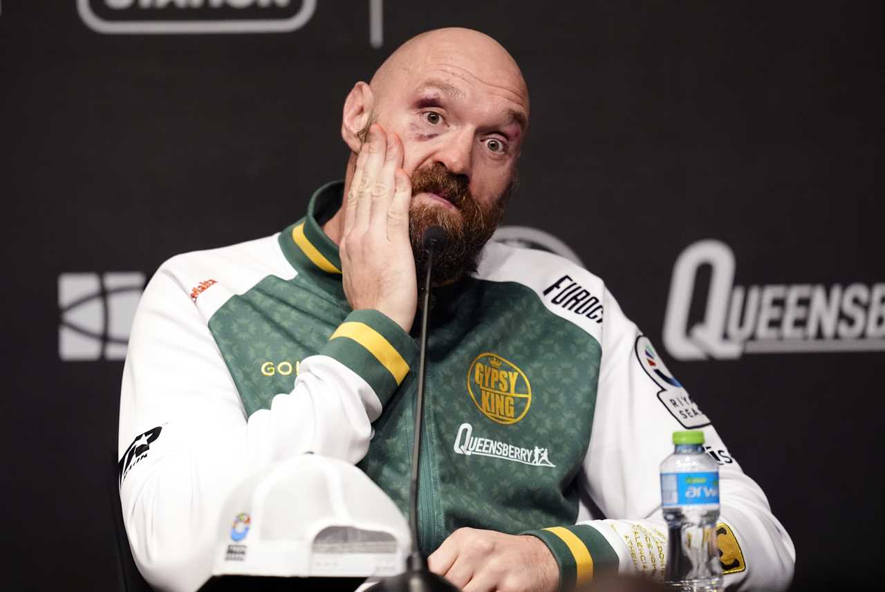 Fury's Retirement Shakes Anthony Joshua's Career - What's Next?