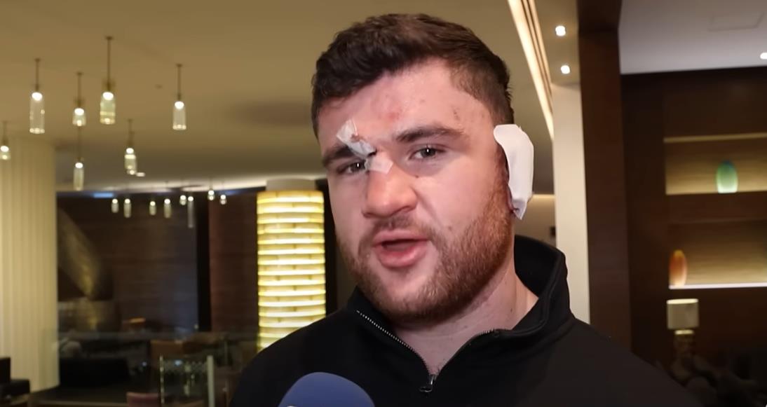 John Fisher Opens Up on Son's Brutal Fight Against Dave Allen